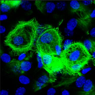 клетки легочного эпителия, цитоскелет окрашен зеленым маркером, ядра клеток синим